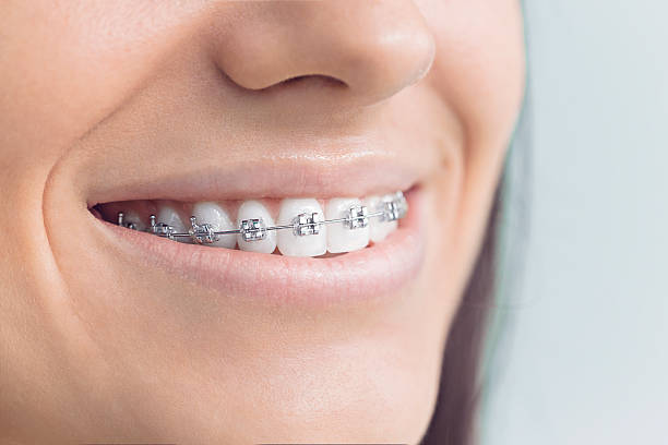 Best Full Mouth Reconstruction  in Columbia, IL
